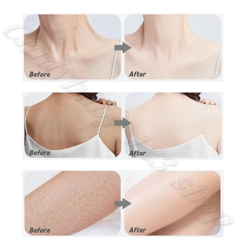 حمض الساليسيليك منعش للتحكم في الزيوت، جل استحمام موس، رغوة الحليب الغنية، تنظيف لطيف لمنع انسداد المسام، حب الشباب #4