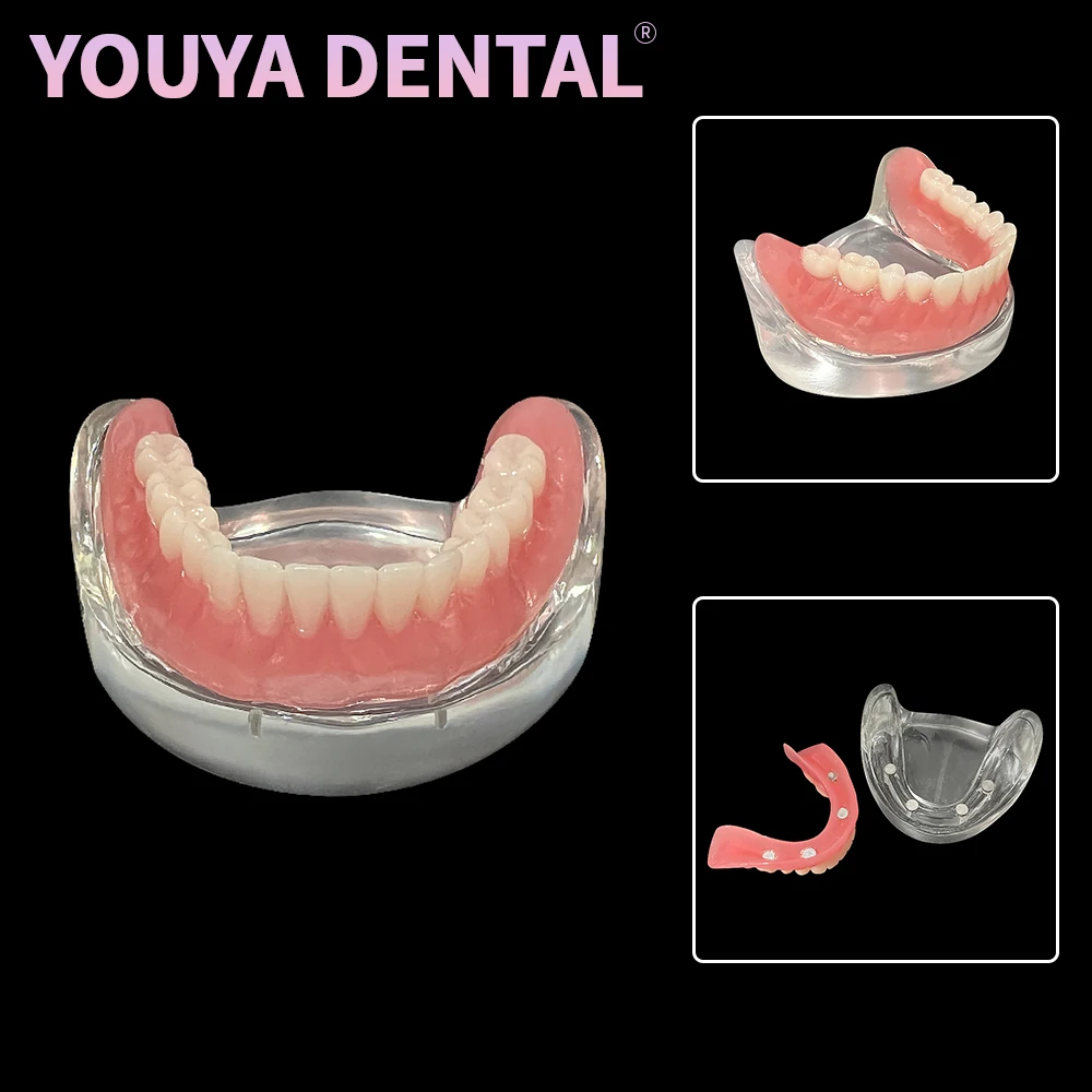 

Модель зубного имплантата со съемным мостом, 4 имплантаты для остатка зубов, декор, модель нижних зубов, обучающая модель зубов