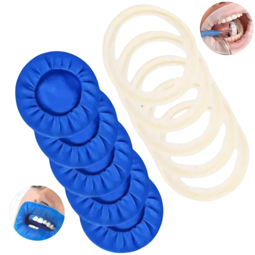 

10PCS JUMTOP Dental Mouth Opener - O-Shape Cheek Retractors for Rubber Dam Procedures, Teeth Whitening and Oral Hygiene Tools