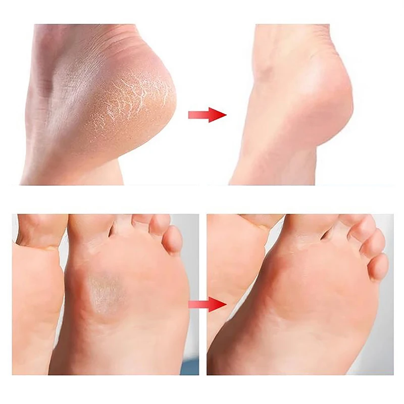 1 sztuk wielokrotnego użytku pumeks do stóp gąbka kamienie pielęgnacja stóp kalus złuszczający środek do usuwania twardego naskórka Pedicure peeling peeling narzędzia do Manicure