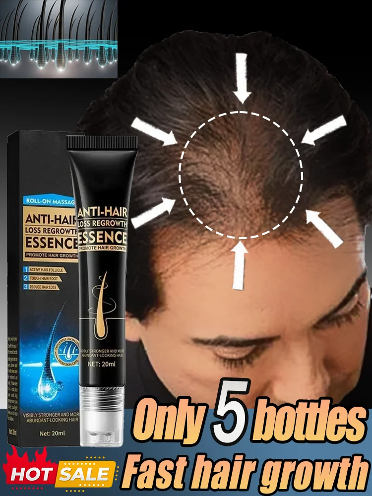 Fast Hair Growth Essence Effective Anti Hair Loss Serum Baldness Repair Hereditary Postpartum Seborrheic Hair Loss oil Care