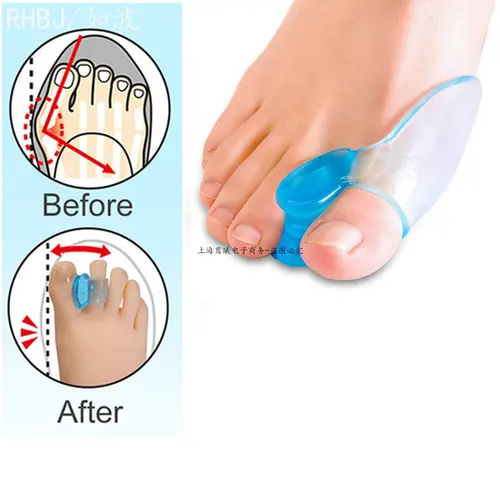 Gel de silicona 2 uds Corrector de pulgar juanete Protector del dedo pequeño separador Hallux Valgus alisador de dedos almohadillas de alivio para el cuidado de los pies
