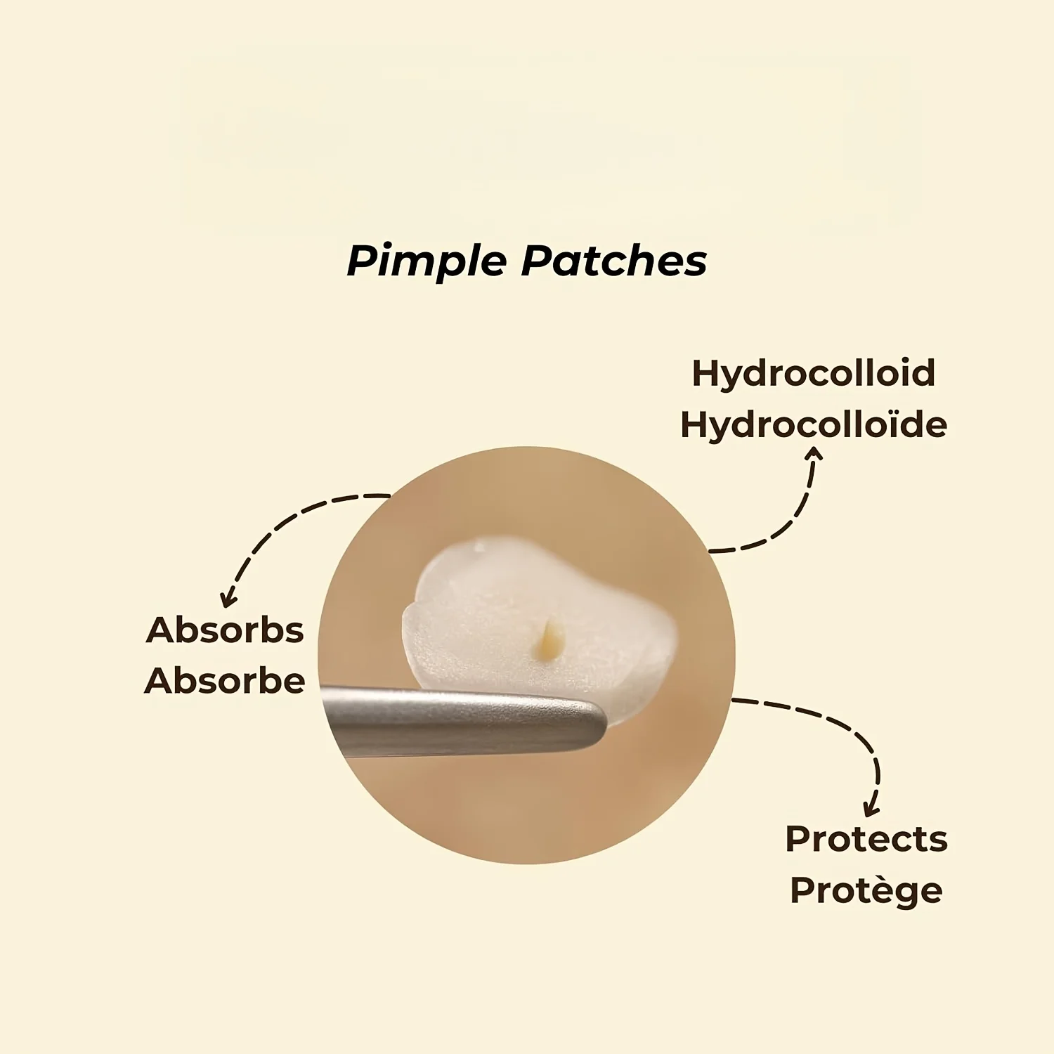 144/192pcs Acne Patch - Cute puppy shaped design, suitable for various light skin tones, daily use&photo props, facial acne patc image 5