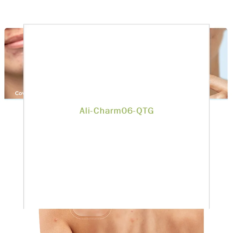 Large Capacity Acne Patch Hydrocolloid Salicylic Transparent Acne Patch Invisible Acne Removal Skin Care Stickers Face Beauty