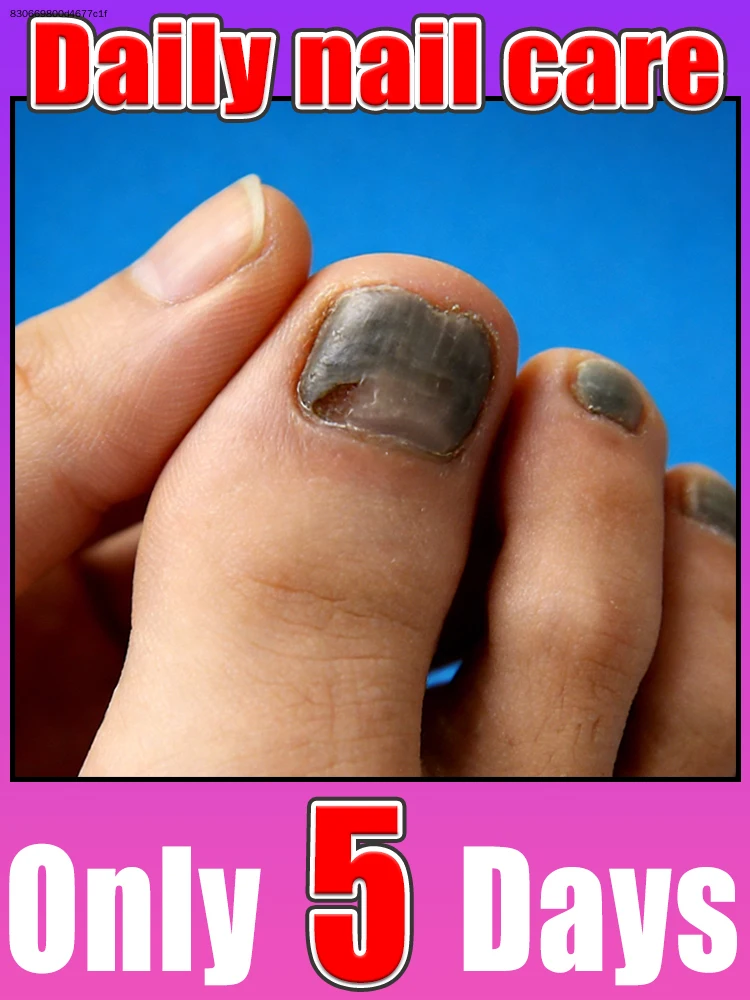 

Bʀᴇᴀᴋ ᴀᴡᴀʏ ғʀᴏᴍ ʀᴏᴜɢʜ sᴘʟɪᴛ ᴄᴜᴛɪᴄʟᴇs, ɴᴀɪʟ ʙᴇᴅs sᴛᴀʏ ᴍᴏɪsᴛ ʜᴇᴀʟᴛʜʏ