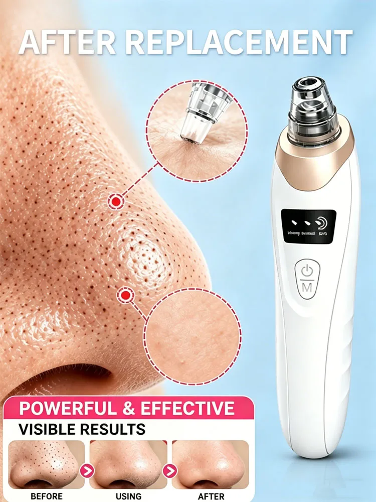 

Professional Blackhead Vacuum - Rechargeable Pore Extractor for Blackheads, Oily Skin & Facial Cleansing