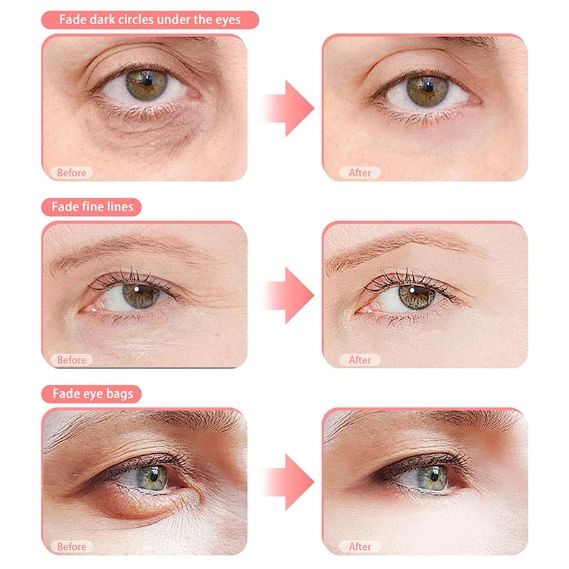 3Dアイマッサージャー 目元リラックスマッサージャー 赤色光 疲労軽減 くま解消 スムースアイ ファインライン 美容アイケアデバイス