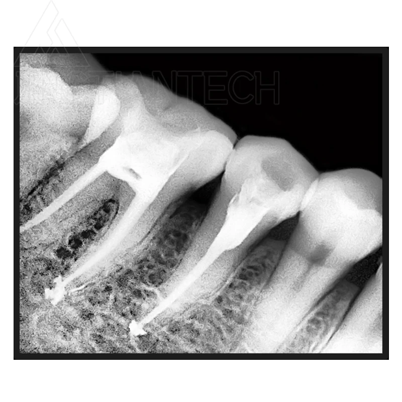 JINGT-máquina de filmación con Sensor Digital Dental, sistema de imagen de medicina con rayos X, cámara de película médica Oral, equipo Dental