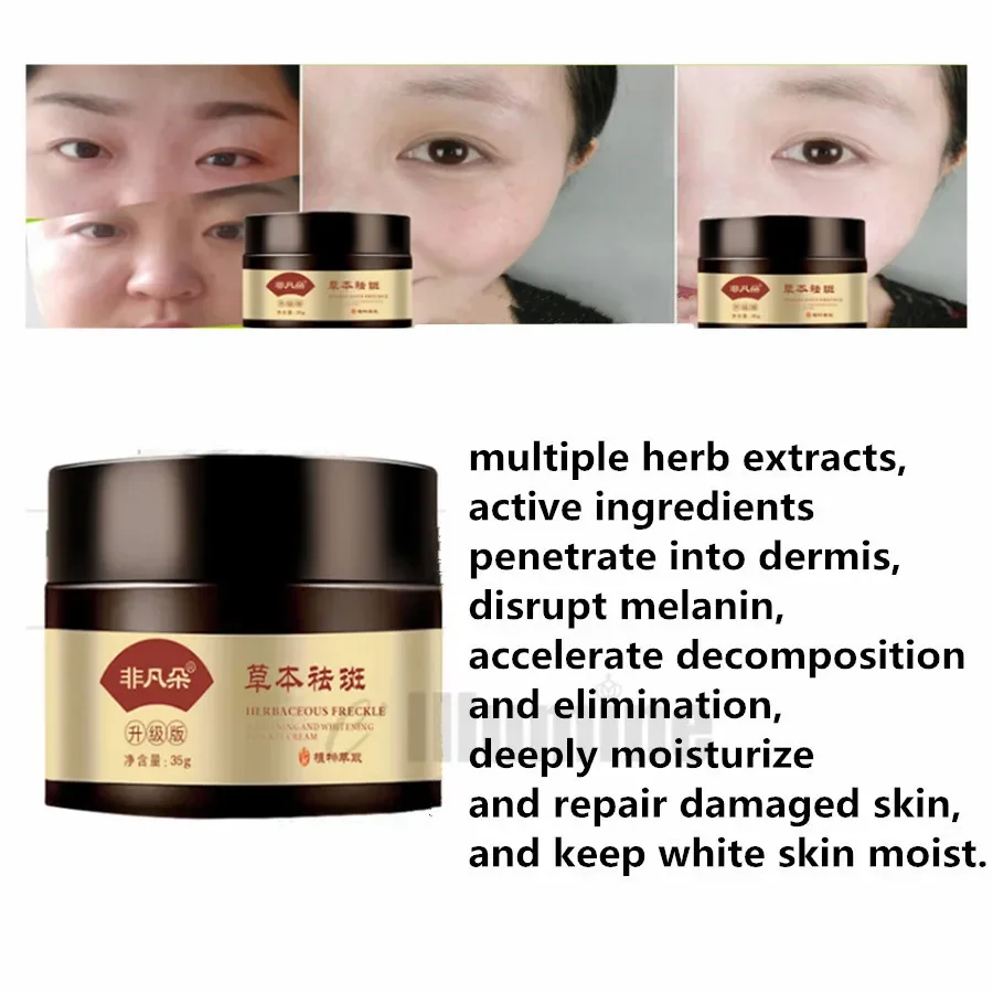 

Freckle Chloasma Repair Cream Freckle Spot Removing Sunburn Spots Whiten Skin Remove Stains 35g