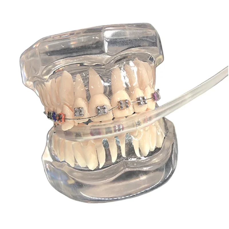 2pcs/packTransparent Orthodontic Cheek Tube Protective Cover Comfortable Lip Guard/Tooth Guard Cover Dental Lip Protector Shield