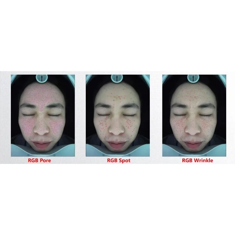 Profesjonalny analizator skóry, włosów i twarzy z funkcją analizy obrazu, sprzęt kosmetyczny do salonów, OEM, sprzedaż 2024/2025