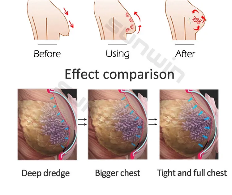 المهنية 80 كيلو التجويف XL أكواب مص الثدي الأرداف توسيع فراغ RF العلاج الوركين شفط آلة تدليك الجسم