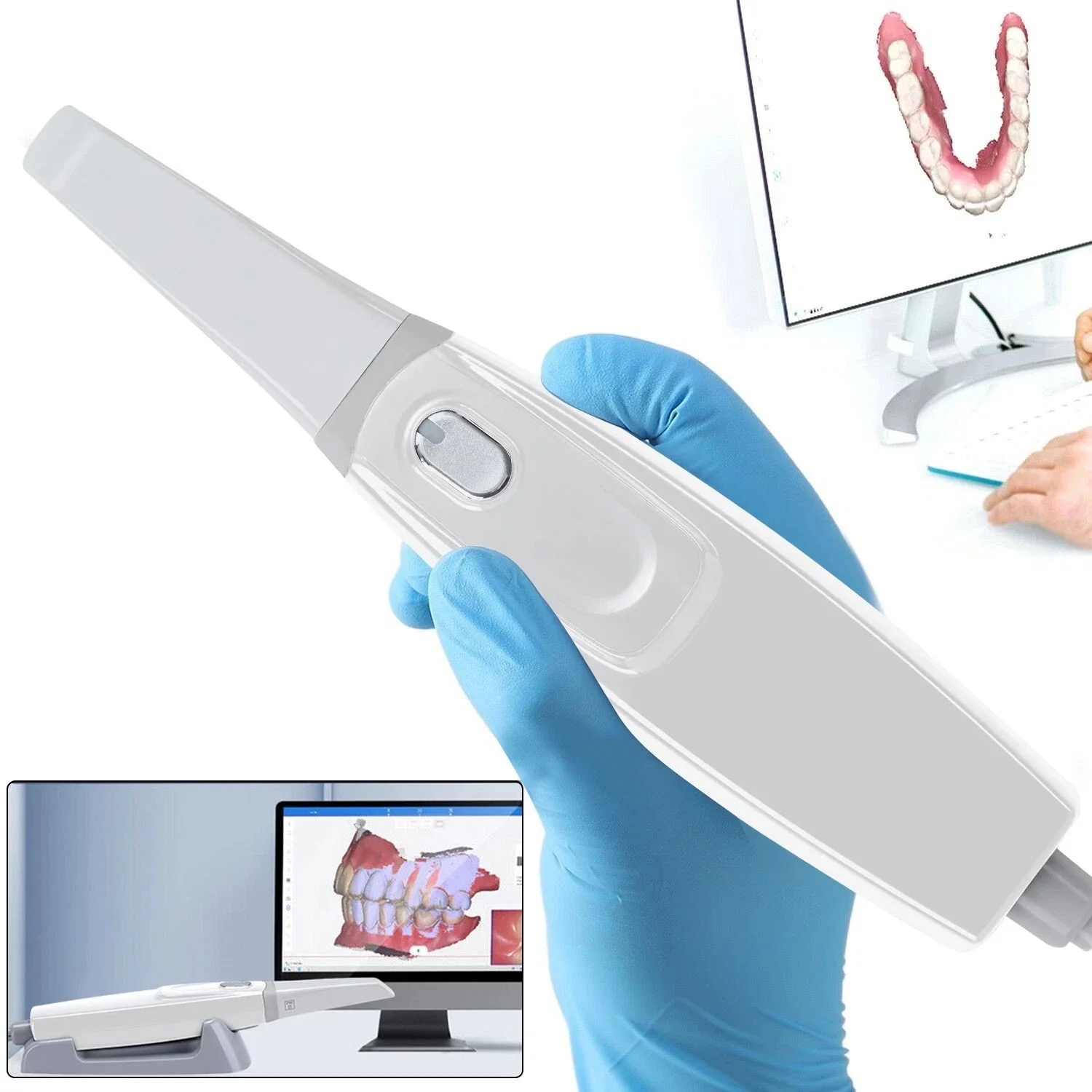 

Dental Digital Scanner 3D Scanning Intraoral Scanner Real Color Dental Implant