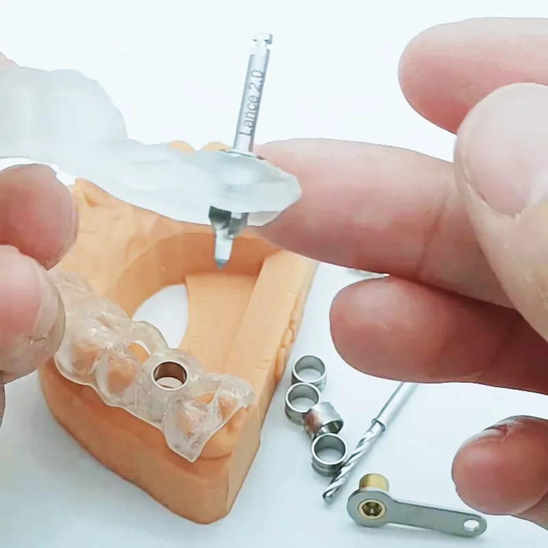 Zahnimplantat, generische chirurgische geführte Hülsen aus Titanlegierung, Zahnhülse 1,5 mm, 2,0 mm, 5,0 mm