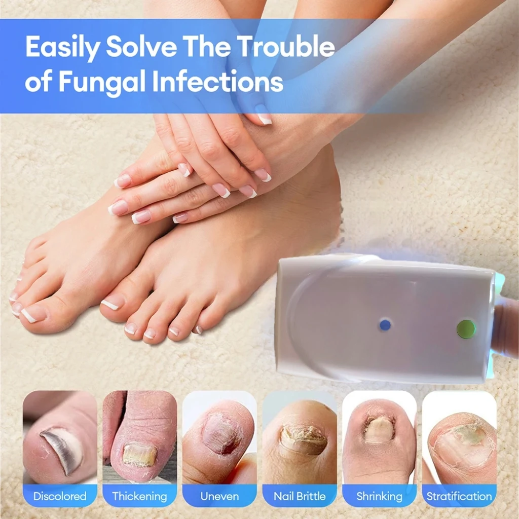 

Professional Nail Fungus Laser Removal Device - Effective for Toenail Fingernail Onychomycosis & Infection
