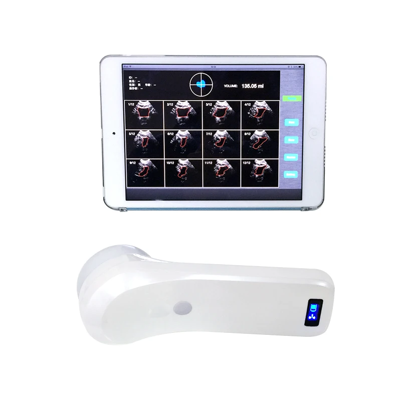 Portable waterproof 4D wireless bladder scanner for Urology Department