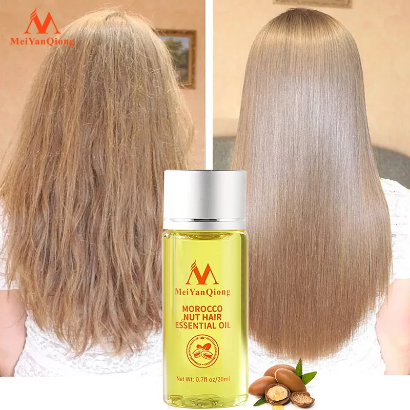 Fast Hair Growth Essence Anti Hair Loss Products Essential Oil Liquid Treatment Preventing Hair Loss Hair Care powerful tonic