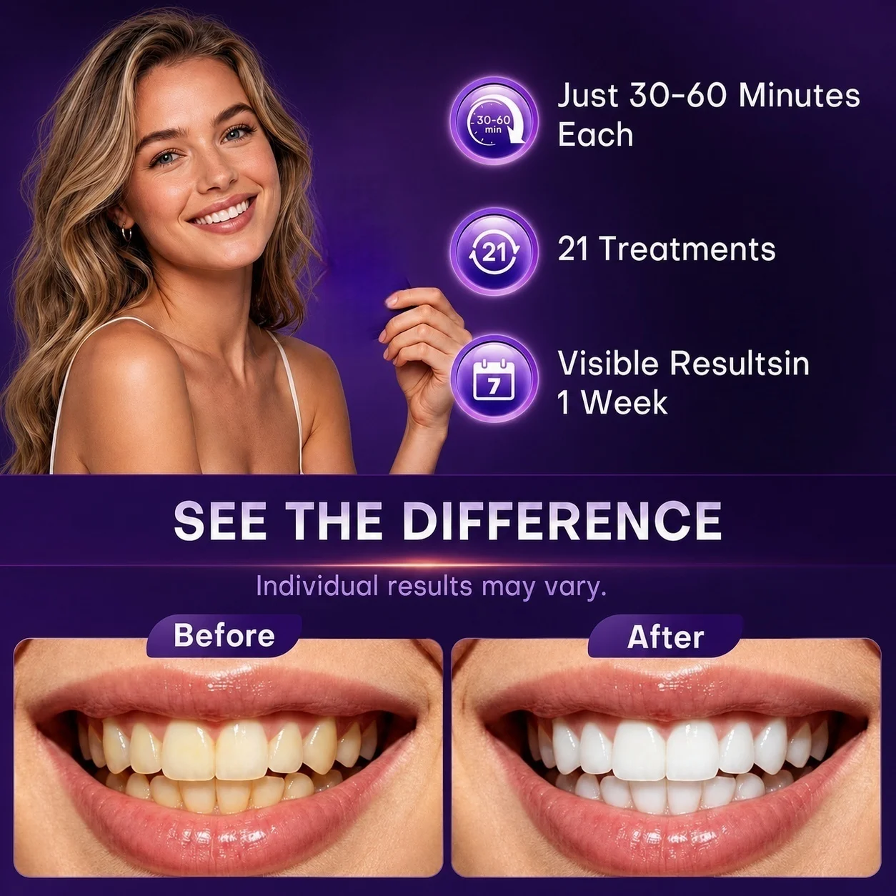 1/7 pares de tiras de clareame - Teeth Whitening Retainer avaliação e preço