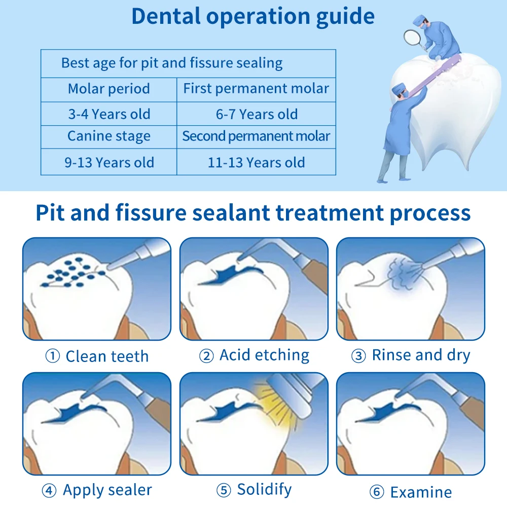 Dental Pit and Fissure Sealant  Light Cure Fluoride-Releasing Resin  Caries Prevention Material for Dentists