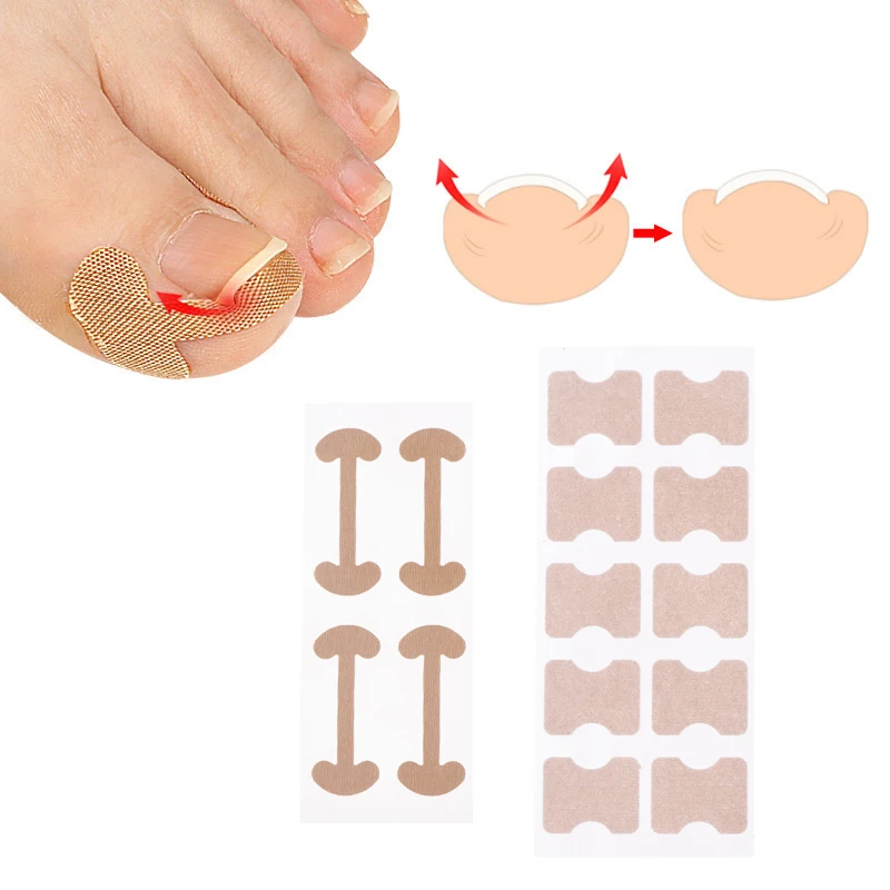 Pegatinas de corrección de uñas encarnadas, parches correctores para tratamiento de paroniquia, herramientas de pedicura, 8/20 piezas