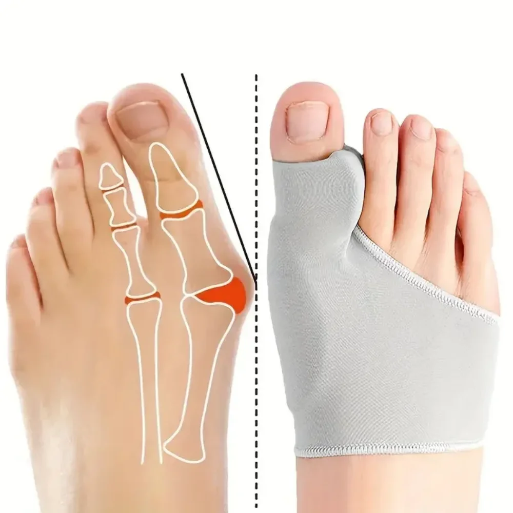 1 Pair of Soft Feet Covers: Big Toe Splitter, Hallux Valgus Corrector Palm Covers for Maximum Comfort