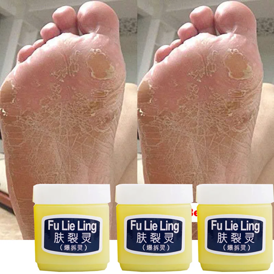 45g *3 Traditional Chinese Clam Oil Hand&Foot Cream Anti Drying Crack Heel Cracked Repair Cream Removal Dead Skin Hand Feet Care