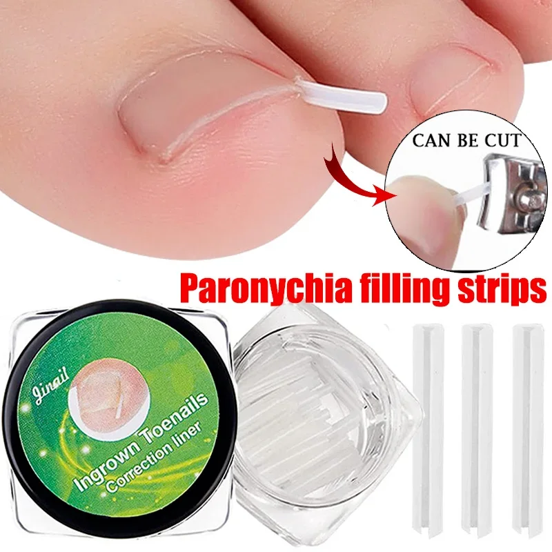 10pcs Ingrown Toenail Correction Tool Ingrown Toe Nail Treatment Elastic Patch Sticker Straightening Clip Brace Pedicure Tool