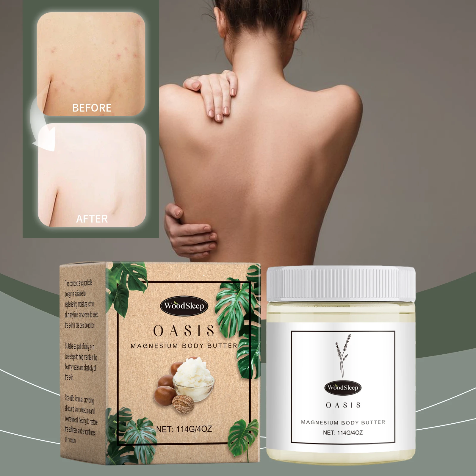 Magnesium Body Butter by WoodSleep – Deep Hydration & Muscle Relief, 114g/4oz – Natural Moisturizer with Magnesium