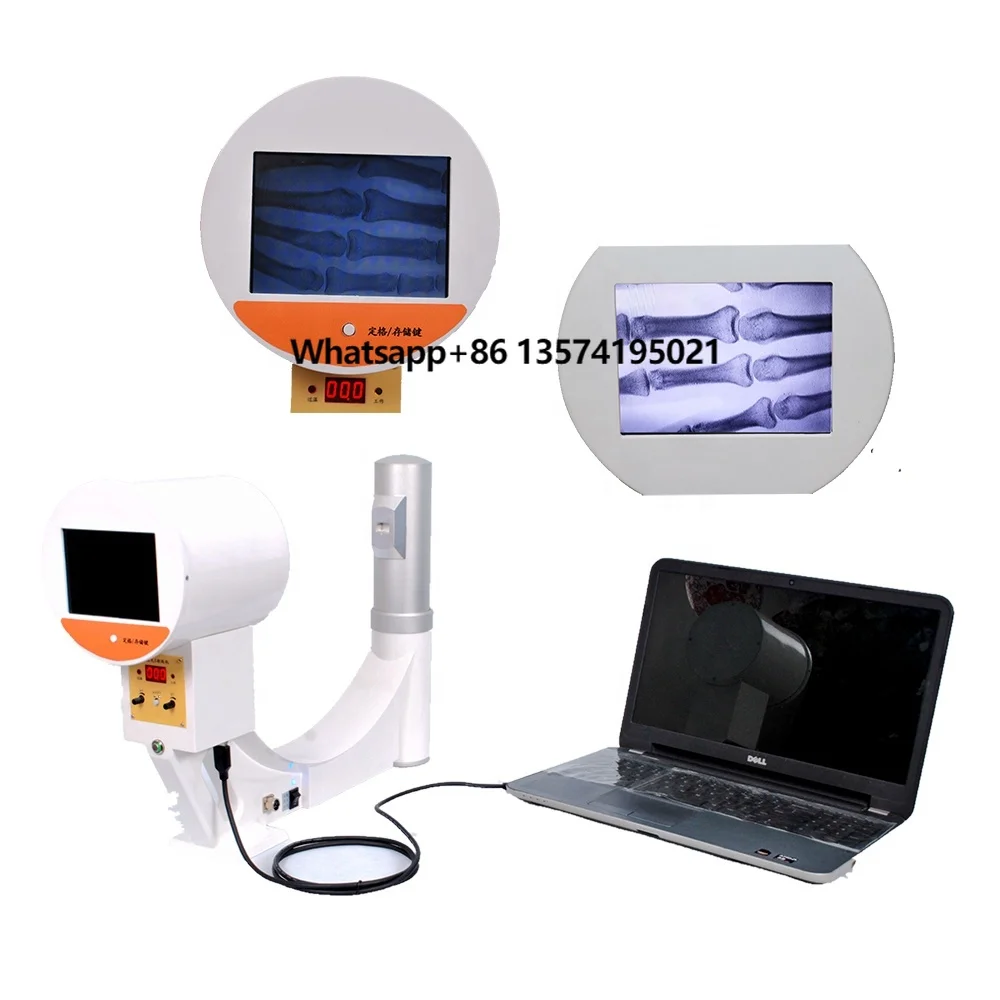 

Portable Fluoroscopy Machine, X-ray Image Intensifier MSLPX32