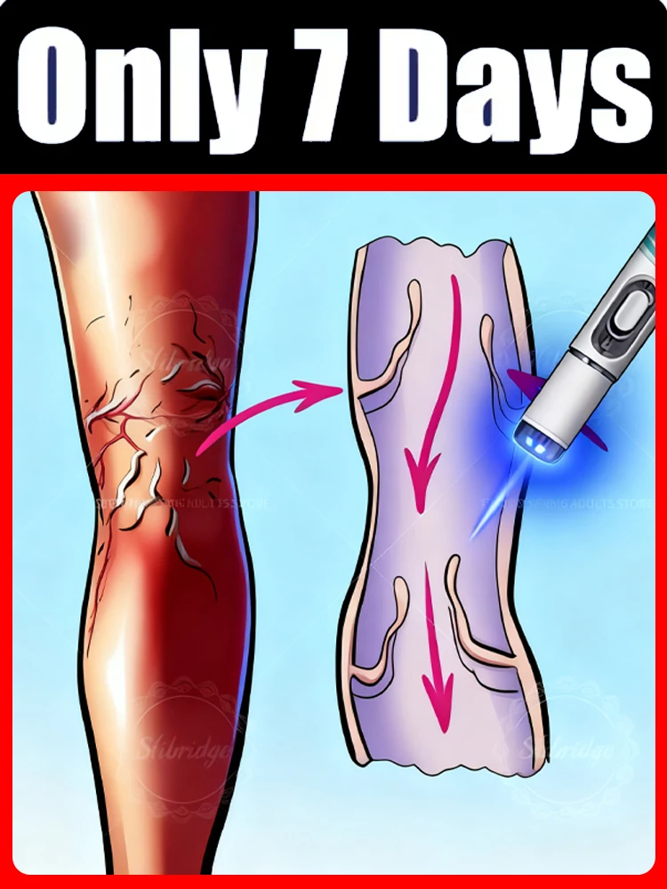 أدوات العناية بالساق تقليل غير مريحة للساقين تحسين الدورة الدموية قلم الضوء الأزرق للجنسين ، عرض ساخن لعام 2025