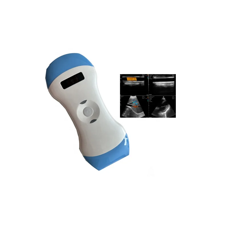 Mobile Wireless Ultrasound 3 in 1  Scanner Wifi Probe