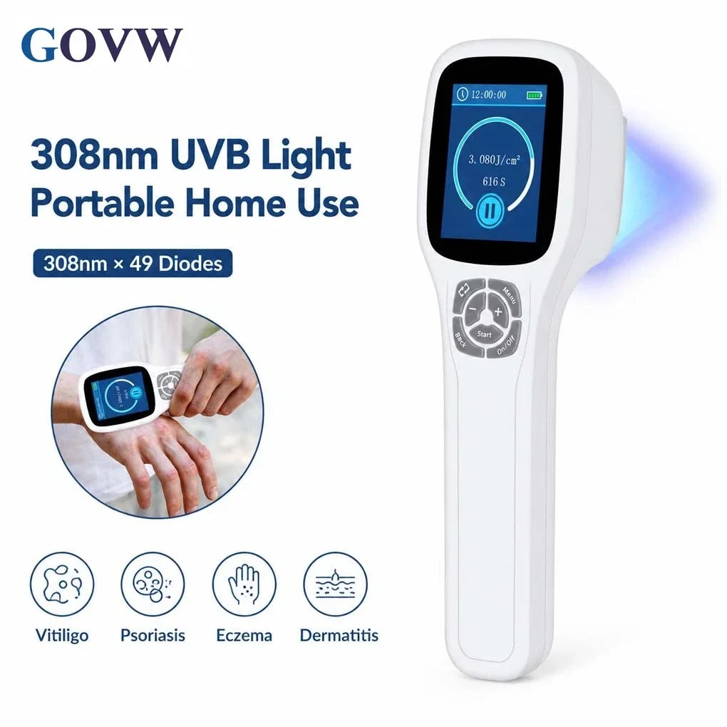 GOVW Portable 308nm UV Light Therapy UVB Phototherapy Instrument for Vitiligo Psoriasis Chronic Dermatitis Skin Spots
