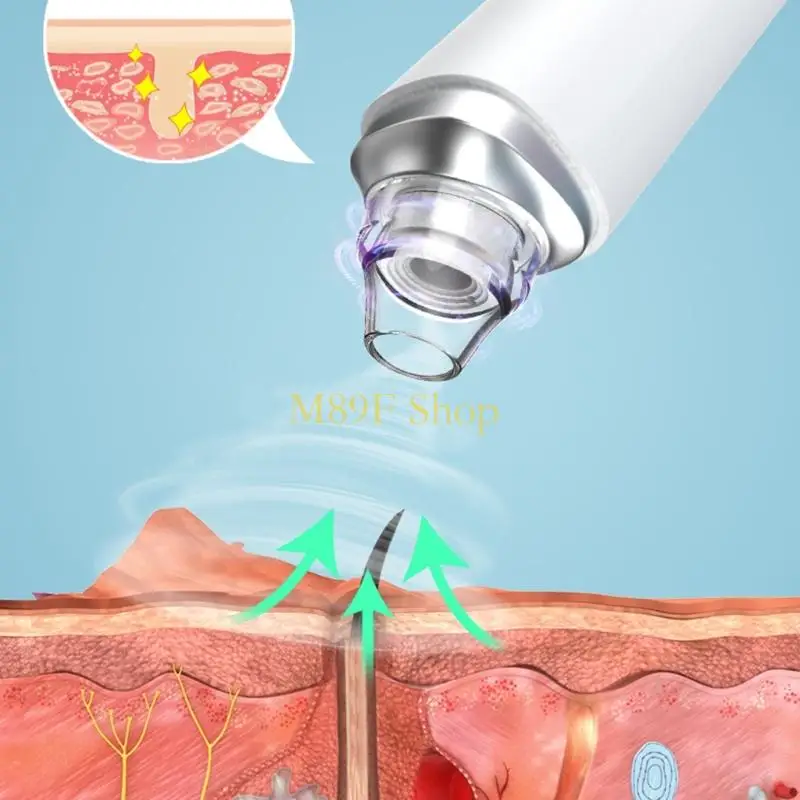 M89F مزيل مسام الوجه القابل لإعادة الشحن ومزيل الرؤوس السوداء 3 مستويات وضع الشفط مقاوم للماء لتنظيف عميق وعرض واضح #4