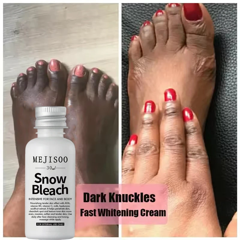 تبييض سريع المفاصل الداكنة سطع كريم اليد الميلانين مصحح ترطيب البقع المكثفة مزيل المنتجات العناية بالبشرة الكورية