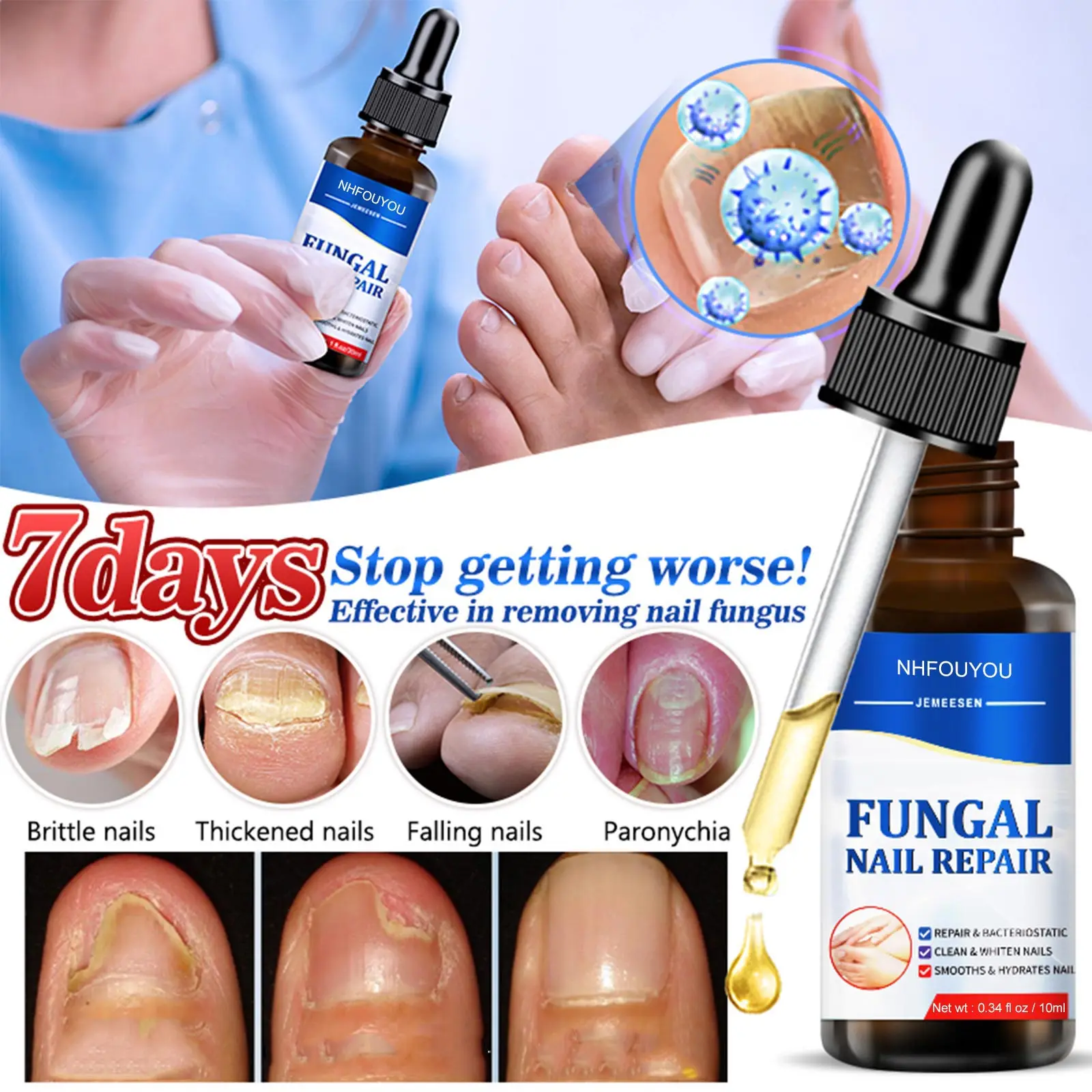 

Nail Fungal Treatment Serum Onychomycosis Paronychia Anti Infection Toe Fungus Hand Foot Removal Repair Gel Care Beauty Health