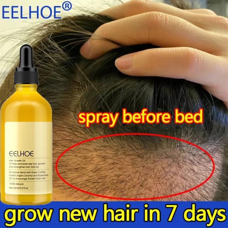 

Fast Hair Growth Oil Africa Crazy Traction Alopecia Serum Anti Hair Break Thicken Hair Loss Treatment Spray For Man Women 60ML