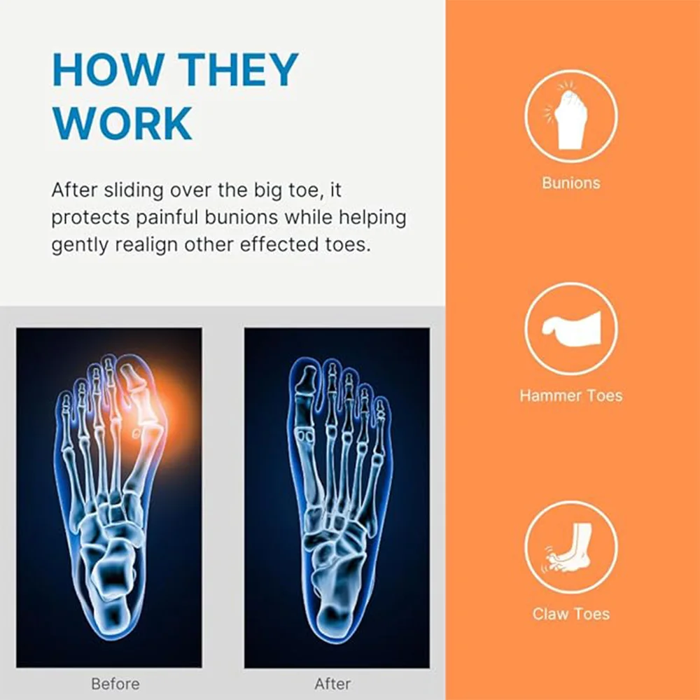Separatore per dita in silicone estensibile da 1 paio, correttore per dita evaporate per pollice grande e osso del piede grande, può essere utilizzato per il pendolarismo quotidiano