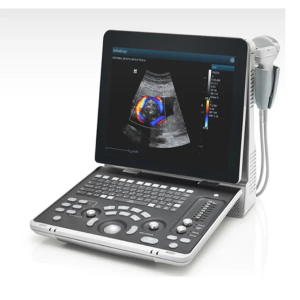 Portable Color  Ultrasound system Medical Ultrasound Instruments