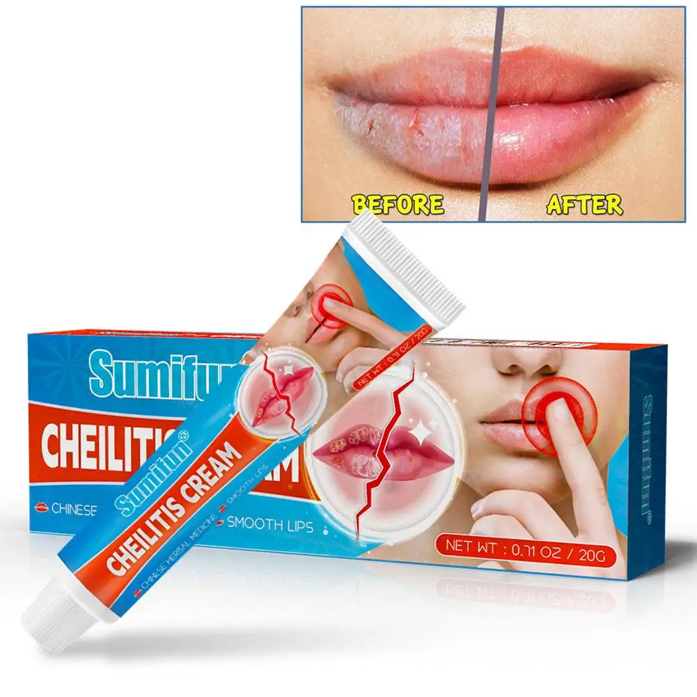 20g Cheilitis Balm cura delle labbra crema esterna per la pelle per Peeling screpolato secco e labbra sanguinanti