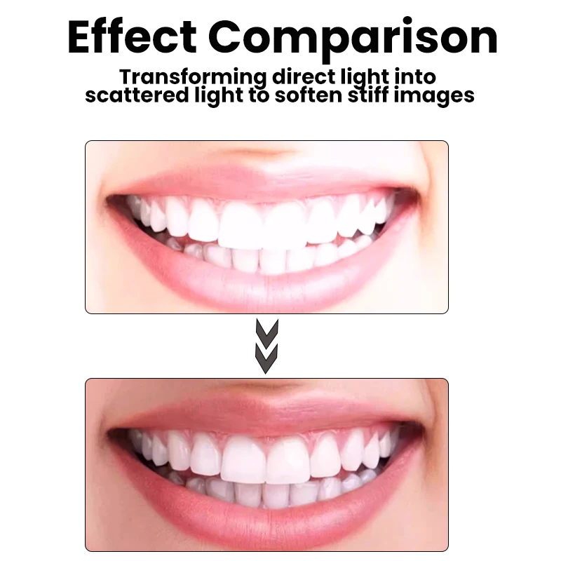 Godox-difusor Dental MF-DD, Kit de cúpula de difusión de Gel de sílice para Godox MF12 Flash