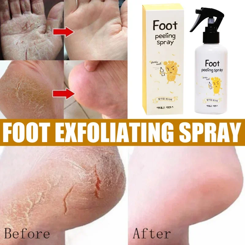 Foot exfoliating repair brightening spray Anti-Drying Crack peeling Treatment Removal Dead Skin calluses feet whiten care liquid