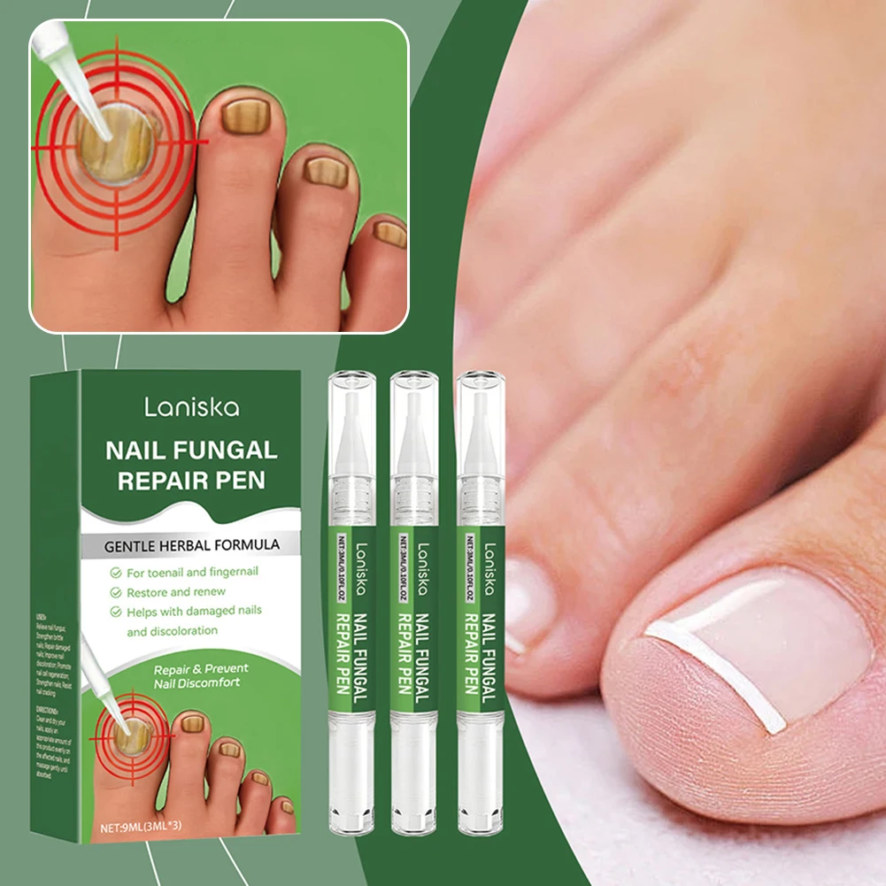 

Ручка для лечения грибков, ручка для поврежденных ногтей, грибок, противогрибковая ручка для ногтей, усиление, обновление повреждения ногтей, для всех типов ногтей