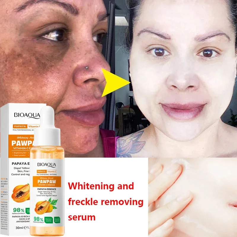 Whiten Freckle Papaya Serum, Eficaz Remover Melasma Dark Spots, Desvanecer-se Melanina, Loção Clareador, Beleza Saúde Cuidados Com A Pele