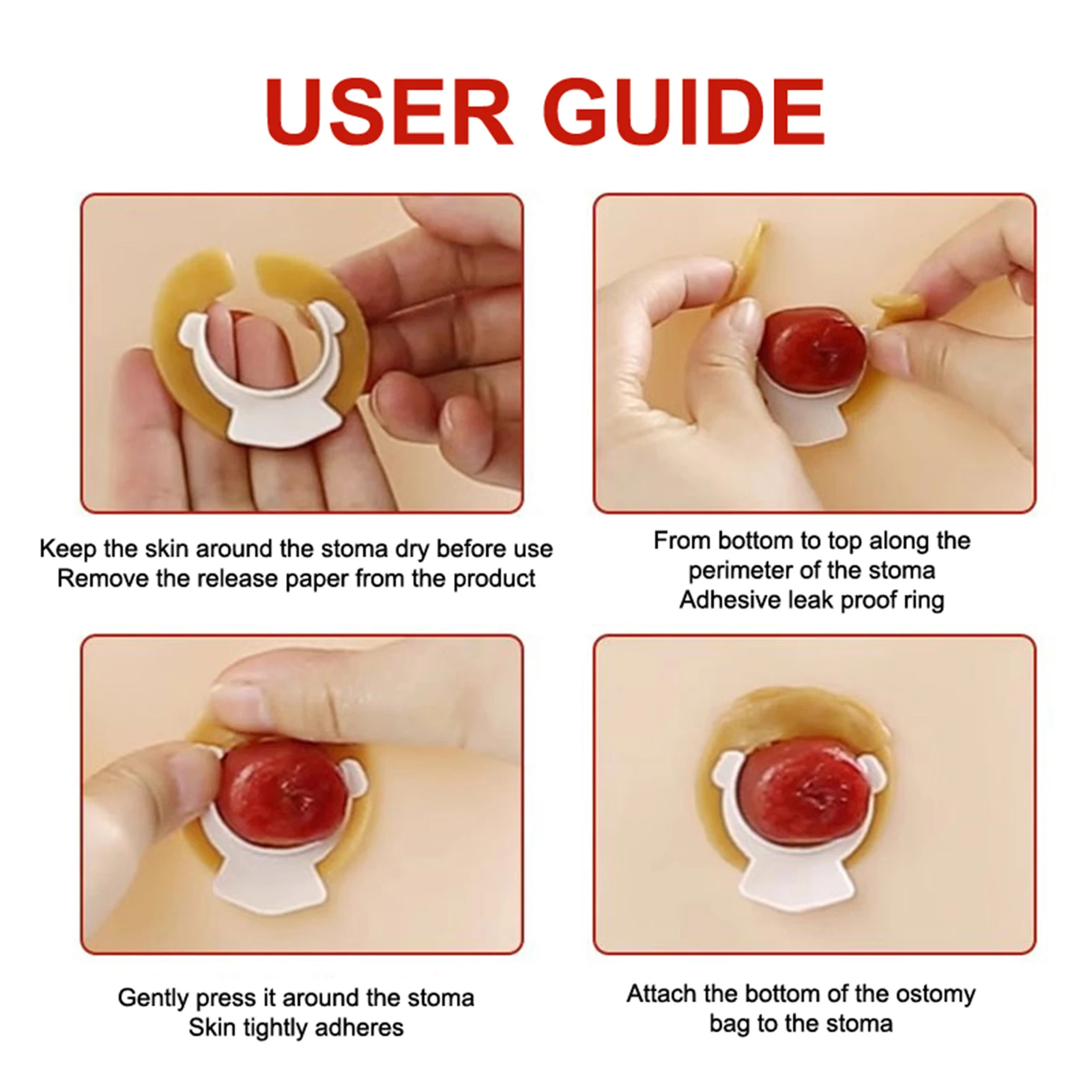 Barrier Stoma Ostomy Strips Tape Skin Supplies Strip Rings Nursing Adhesive Pressure Fixing Colostomy Leak Proof Ileostomy Pouch