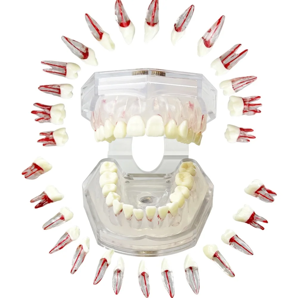 Dental Model With 28pcs Root Canal Block Training Tooth Pulp Cavity Practice Model Full Mouth Removable Teeth Typodont Training