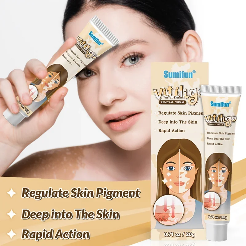 Vitiligo Cream Reduce White Spots Melanin Deposits Repair Skin Leukoplakia Disease Relieve Skin Itch Herbal Ointment Care 20g