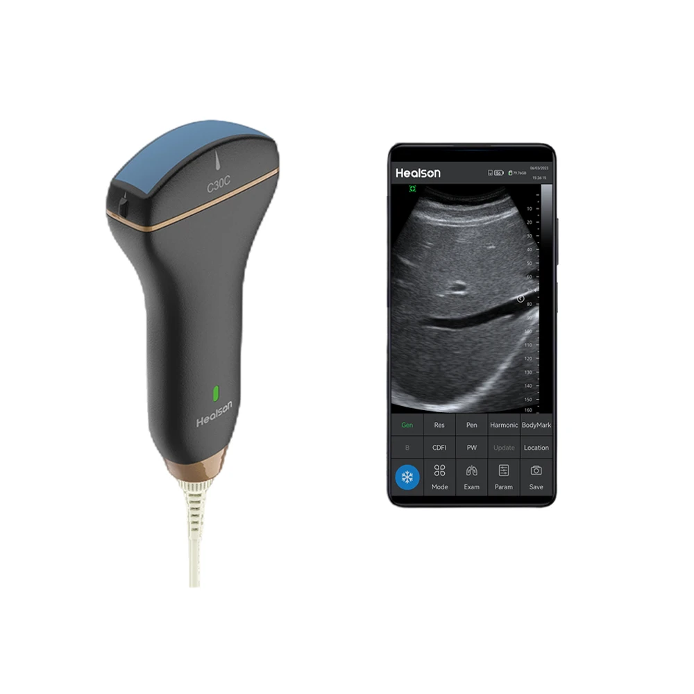 Healson Portable Ultrasound Machine C30C Color Doppler Convex Ultrasound Scanner with Android Mobile phone for Abdomen, Bladder