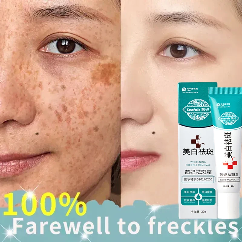 Effective Whitening Freckle Cream Remove Melasma Melanin Dark Spots Cream Moisturizing Nourishing Brighten Smooth Face Skin Care