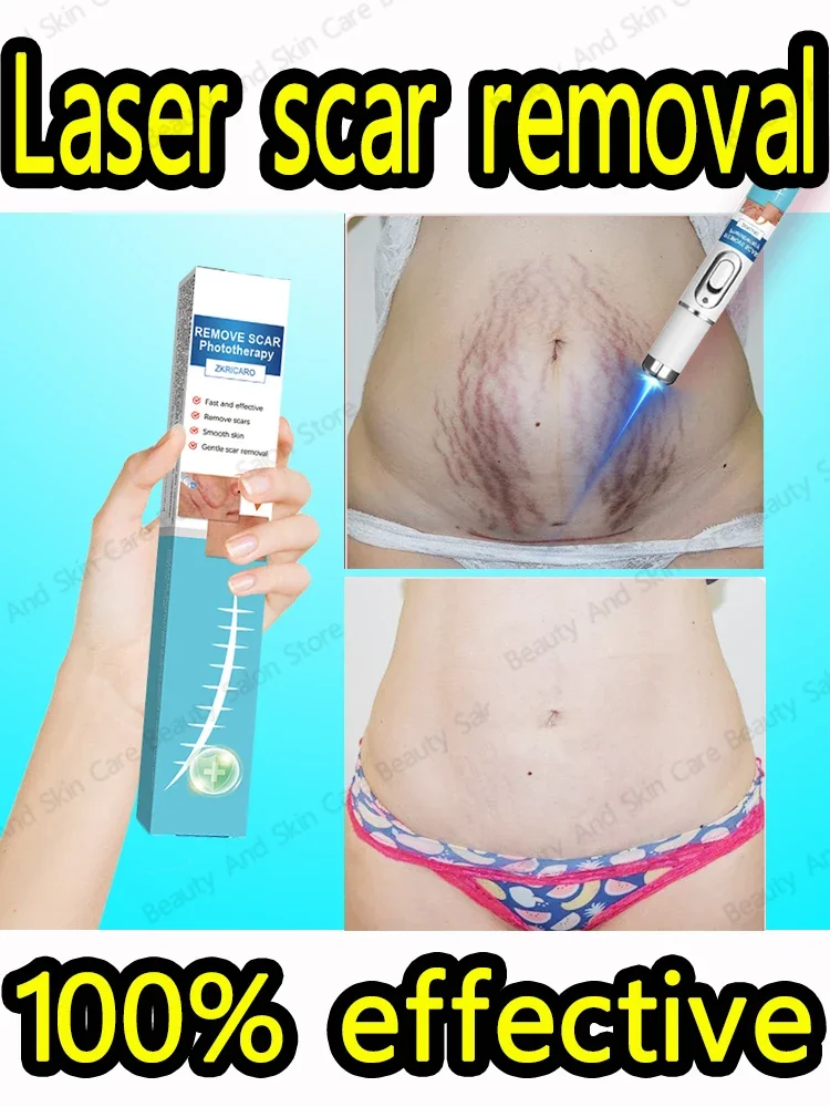 Scars? Knife scars? Surgery scars? Tattoo scars? Burn scars? Fall scars? Quick recovery in 7 days