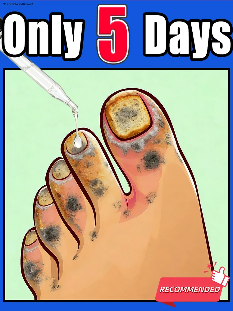 

Fʀᴇᴇ ғʀᴏᴍ ᴄʜᴀᴘᴘᴇᴅ ᴄᴜᴛɪᴄʟᴇs, ᴋᴇᴇᴘ ғɪɴɢᴇʀᴛɪᴘs ɴᴏᴜʀɪsʜᴇᴅ